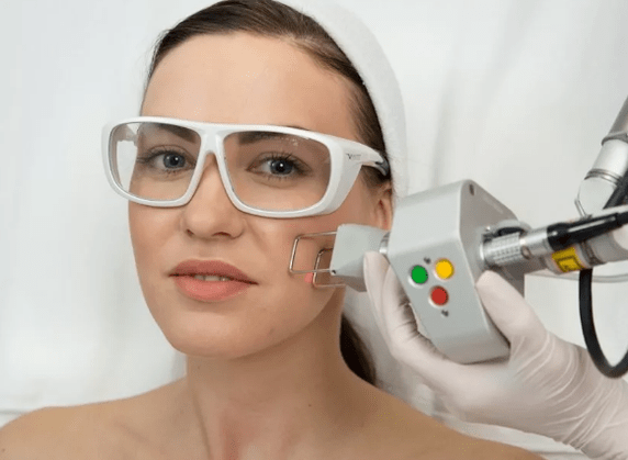 Feldlaserverjüngung