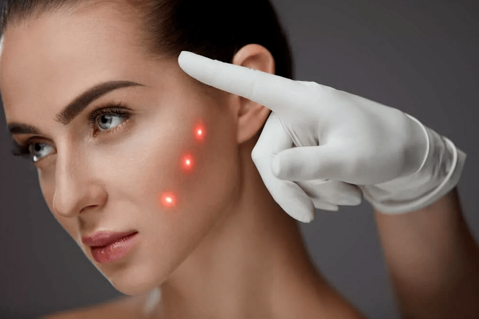 Verjüngungsmethoden